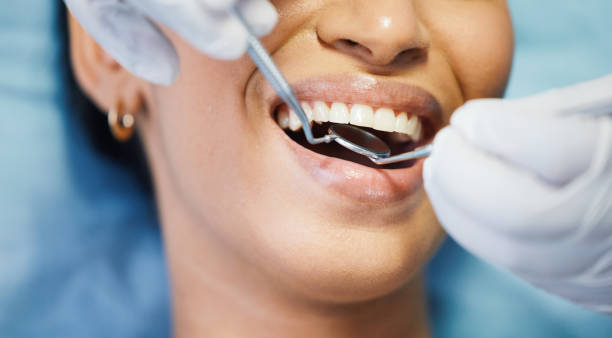 Best Emergency Dental Extractions in Darnestown, MD